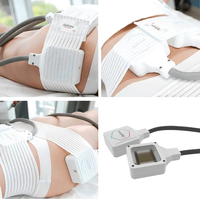 Delinea-Body-Contouring-Band