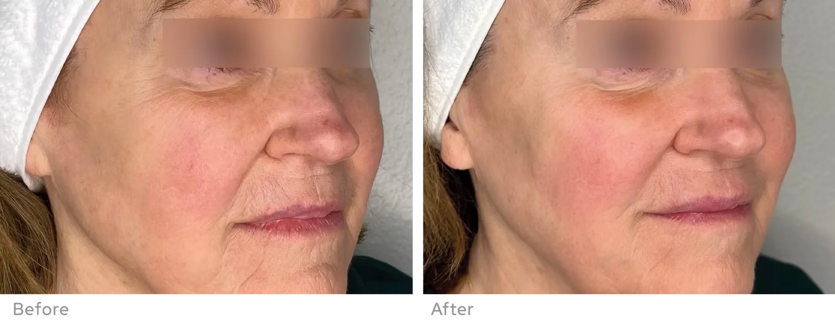 imageye___-_60eb10_4988e31732674c7aac96d849fb853001~mv2