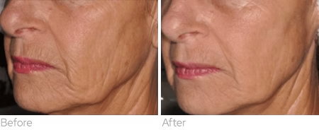 imageye___-_ed2975_46b1de3fb7644f1daaa0d8ea50241ba0~mv2